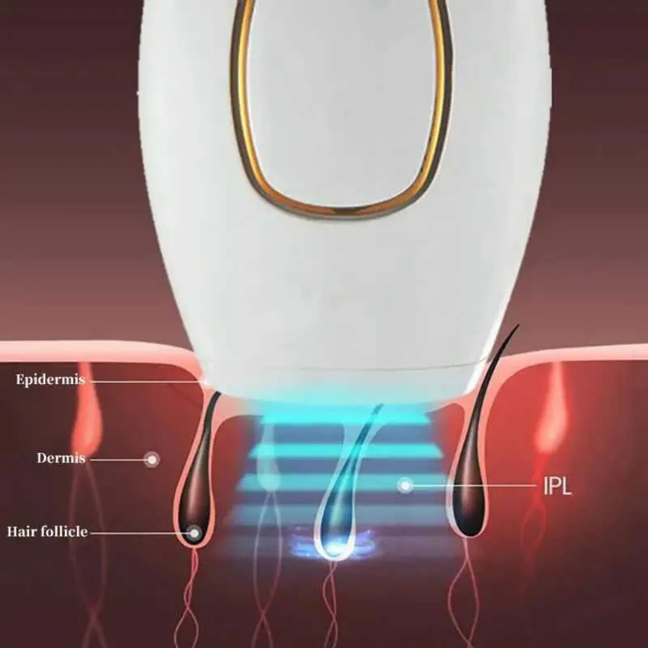 IPLStar, urządzenie do depilacji laserowej - Image 9