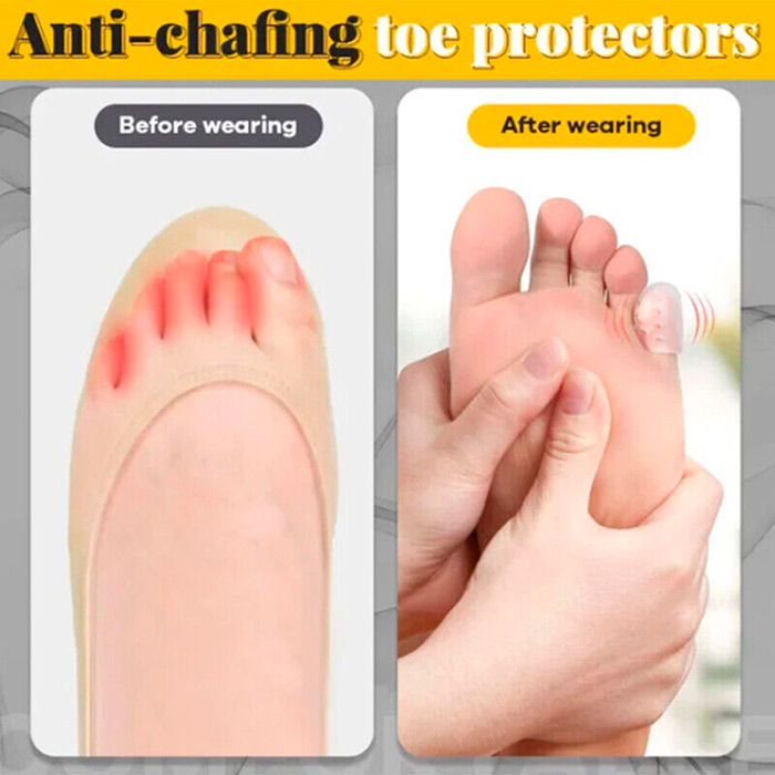ToeProtector, silikonowe ochraniacze na palce (10 sztuk) - Image 5